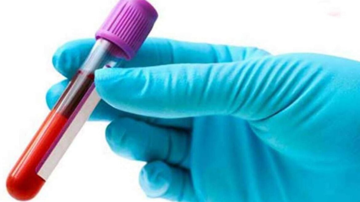 Análisis de sangre permite diagnosticar Alzheimer en fase temprana